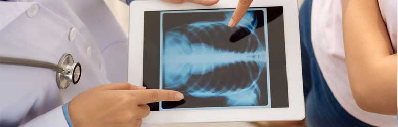 Как Делают Рентген Легких Женщинам Фото